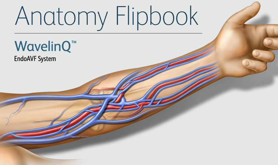 BD Peripheral Intervention